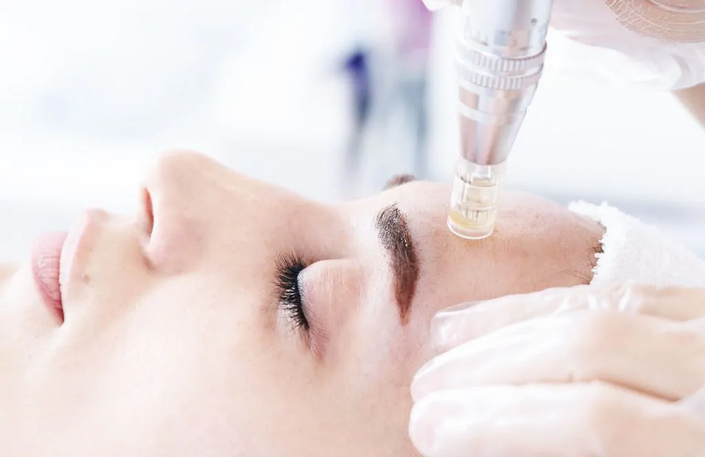 Biogenica medycyna estetyczna Poznań - mezoterapia mikroigłowa